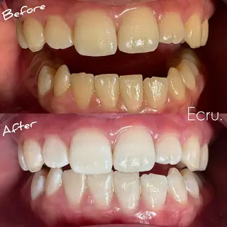 メンズ キッズ ホワイトニングサロン Ecru所属・ホワイトニングサロン Ecru エクリュのその他イメージ