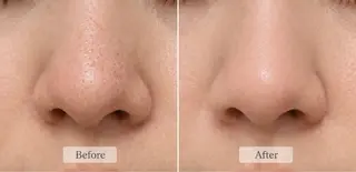 Mythica 横浜 ハーブピーリング小顔のエステ・リラクイメージ