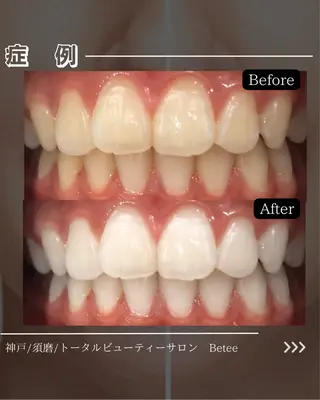 セルフホワイトニングサロン　Betee所属・セルフホワイトニング Beteeのエステ・リラクイメージ