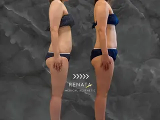 RENATA🕊 脂肪冷却専門店六本木のエステ・リラクイメージ