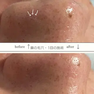 Luce所属・Luce Shokoのエステ・リラクイメージ