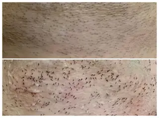 医療提携メンズ脱毛 CDFAkasakaのエステ・リラクイメージ