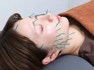 乃々鍼灸・整体院　表参道所属・乃々鍼灸整体院　植木 　【美容鍼/整体】のエステ・リラクイメージ