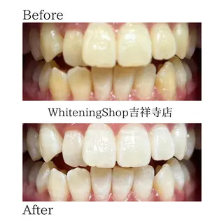 ホワイトニング ショップ吉祥寺店のエステ・リラクイメージ