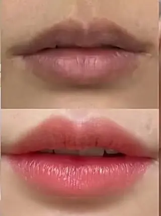 esperanza エスペランサのエステ・リラクイメージ