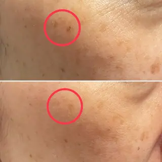 痛くないシミ取り 【荻窪】石橋のヘアスタイル