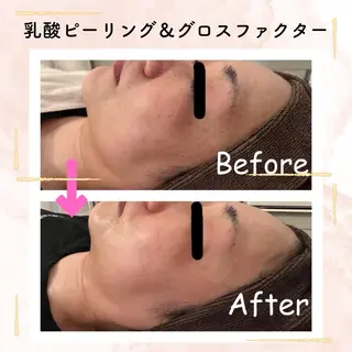beauty SalonRcoinのマツエク・マツパデザイン