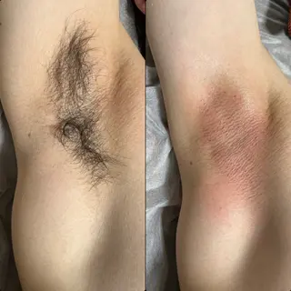 六本木脱毛andS さおりのエステ・リラクイメージ