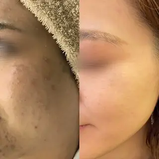 小顔×痩身専門サロンCLORE浦和店所属・石川 彩花のエステ・リラクイメージ