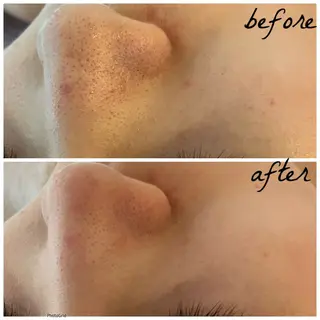 メンズ メナード岐阜市茜部 杉浦のエステ・リラクイメージ