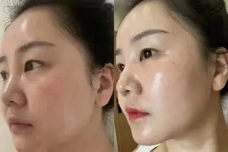 ネイル aliaハイフ&水光ジェットサロン所属・aliaハーブ水光店 エステティシャン募集のエステ・リラクイメージ