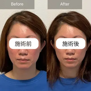 BLOOM .のエステ・リラクイメージ