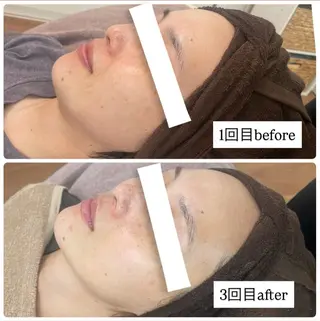 ルアナ プライベートサロンのネイルデザイン