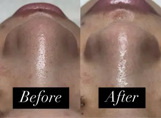 ルシール所属・脱毛＆小顔コルギ 専門店 Lucirのエステ・リラクイメージ