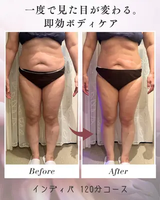 boju reborn所属・インディバ温活ケア 痩身ダウンタイム妊活のエステ・リラクイメージ