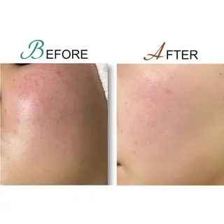 脱毛サロン　LILIAN所属・脱毛・美肌サロン LILIAN 脱石油のエステ・リラクイメージ