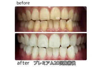 凛 リンのネイルデザイン