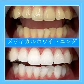 Monreve所属・美人スイッチdiet スーパージェクションのその他イメージ