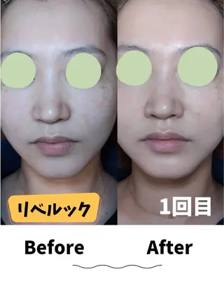 コンセプトサロン友 木下のエステ・リラクイメージ