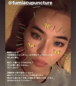 THE  ROOTS所属・美容鍼♡小顔矯正♡ fumikaのエステ・リラクイメージ