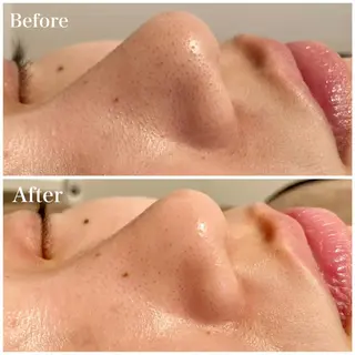 アイブロウ Ｂ&H所属・頭痛•肩こり専門/ 眉サロンB&H心斎橋のエステ・リラクイメージ