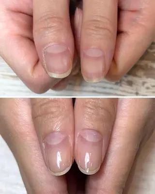 ネイル 深爪矯正・自爪育成 ネイルサロンアモまいのネイルデザイン