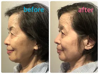 安眠ヘッドスパ美整体 🌿白金/目黒/鈴木のエステ・リラクイメージ