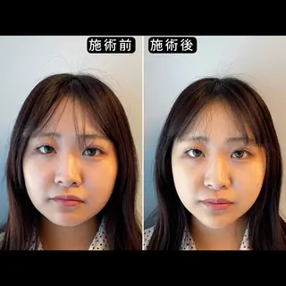 渋谷 小顔美容鍼 専門サロン YZのエステ・リラクイメージ