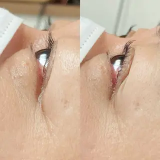 マツエク・マツパ Sola所属・岡島 奈美のエステ・リラクイメージ