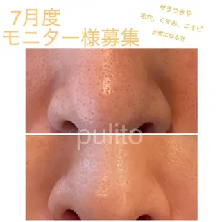 プリート毛穴洗浄美肌 Pulitoのエステ・リラクイメージ