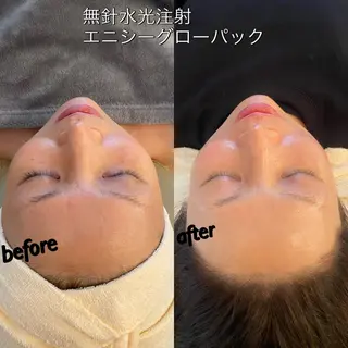 うなじ脱毛/美肌脱毛 LABELのエステ・リラクイメージ