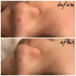 メンズ メナード岐阜市茜部 杉浦のエステ・リラクイメージ