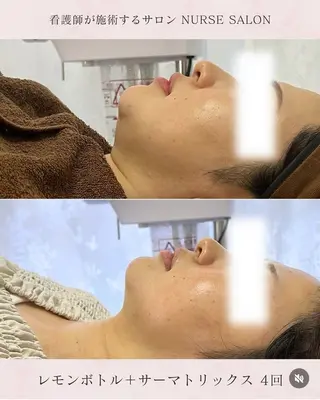 💐美肌/小顔づくり 🫧看護師🫧ASAのエステ・リラクイメージ