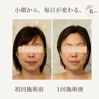 小顔サロンラヴィ　　船橋馬込沢店所属・小顔サロンラヴィ 船橋のエステ・リラクイメージ
