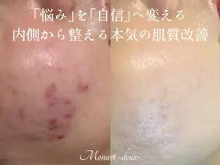 Monart -deux-のエステ・リラクイメージ