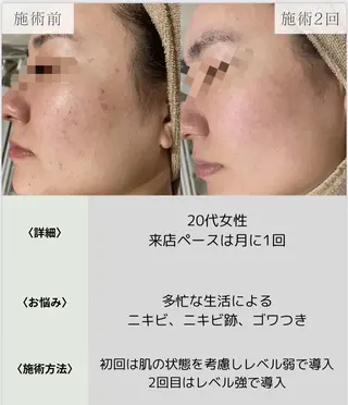 脱毛・眉毛・フェイス サロンN久留米店の眉毛・アイブロウイメージ