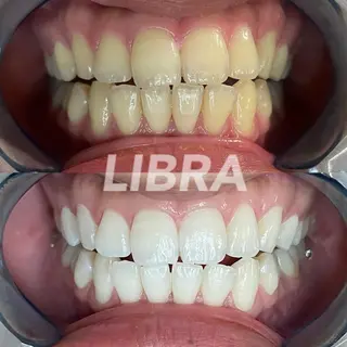 Libra所属・LIBRA心斎橋 セルフホワイトニングのその他イメージ