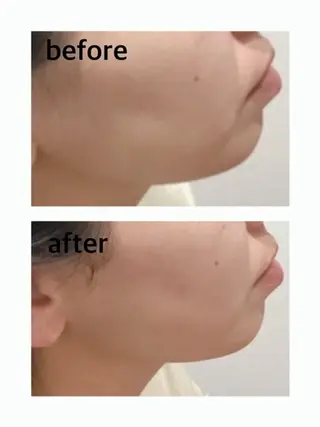 Pullulant EstheKyotoのエステ・リラクイメージ