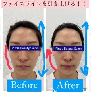 ブライダル痩身×脱毛 尼崎駅前サロンのエステ・リラクイメージ