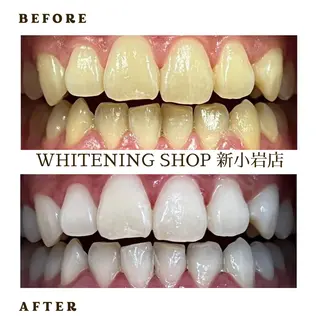 メンズ ホワイトニング ショップ新小岩店のその他イメージ