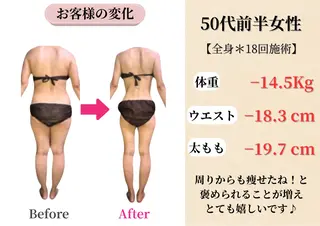 Belle White所属・本格痩身＊肌質改善＊ BelleWhiteのエステ・リラクイメージ