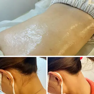 うなじ脱毛/美肌脱毛 LABELのエステ・リラクイメージ