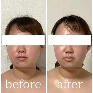 毛穴肌質ケアサロン Yourmeユアミーのエステ・リラクイメージ