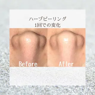 ゆか/エステサロン Lilasmileのエステ・リラクイメージ