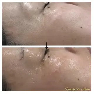 ビューティー ミロワールのエステ・リラクイメージ