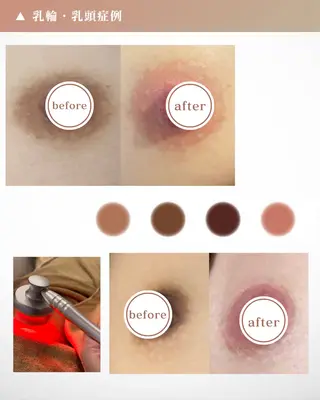 本気で痩せたい方へ 痩身専門サロンのエステ・リラクイメージ