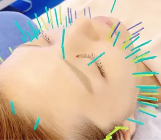 小顔美容鍼専門サロン 渋谷YZのその他イメージ