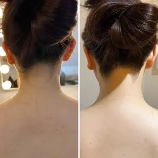 うなじ脱毛/美肌脱毛 LABELのエステ・リラクイメージ