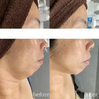 DahliaBeauty ダリアビューティー所属・Dahlia痩身脱毛 フェイシャル 中村のエステ・リラクイメージ