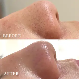 メンズ ACE. beauty salon所属・竹本 奈緒のエステ・リラクイメージ